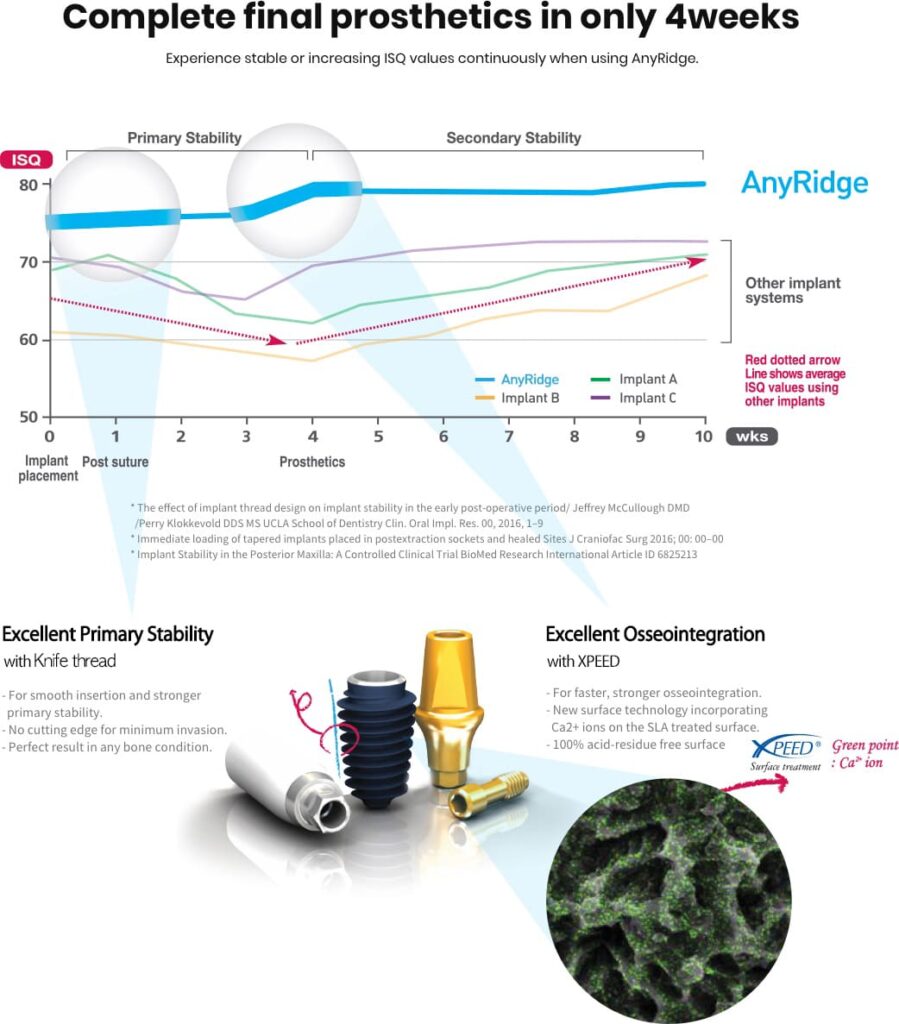 Grafico sulla stabilità dei migliori impianti dentali AnyRidge Megagen