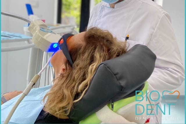 Sbiancamento denti professionale dai dentisti in Albania della Clinica Dentale Biodent