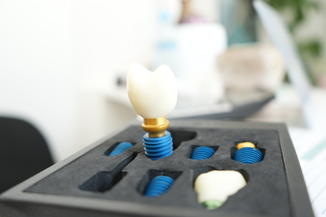 Prezzi per impianti dentali: visita in clinica dentale Biodent con dentisti in Albania per soluzioni implantari accessibili