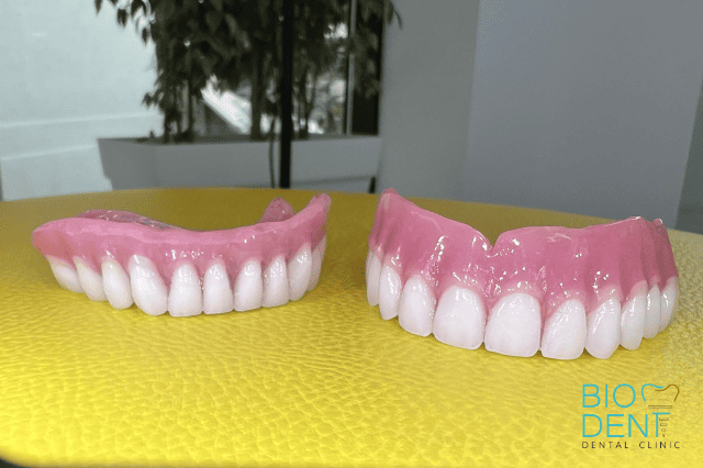 Protesi all on four in resina realizzata da dentisti in Albania Biodent